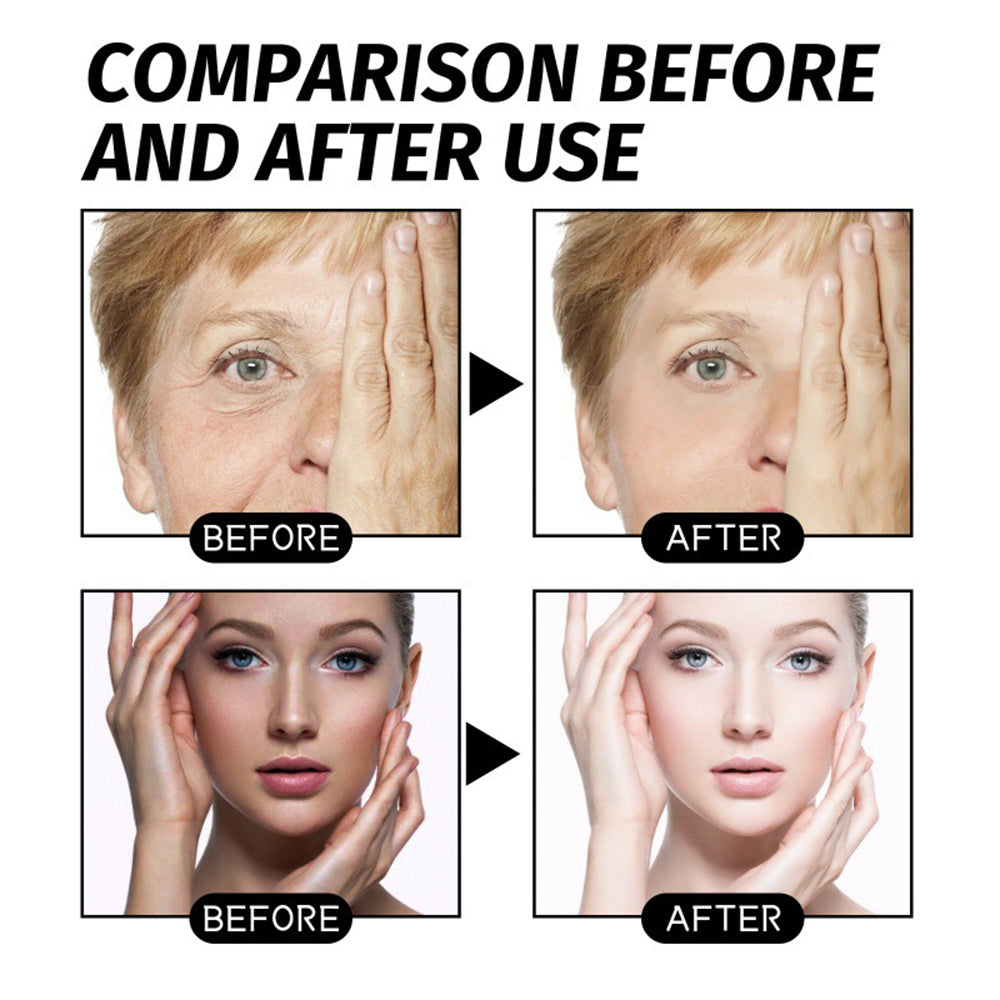 （✨✨LAST DAY 70 % OFF）ANTI-WRINKLE SKINCARE SET Eye Cream + Neck Cream-Perfect Duo