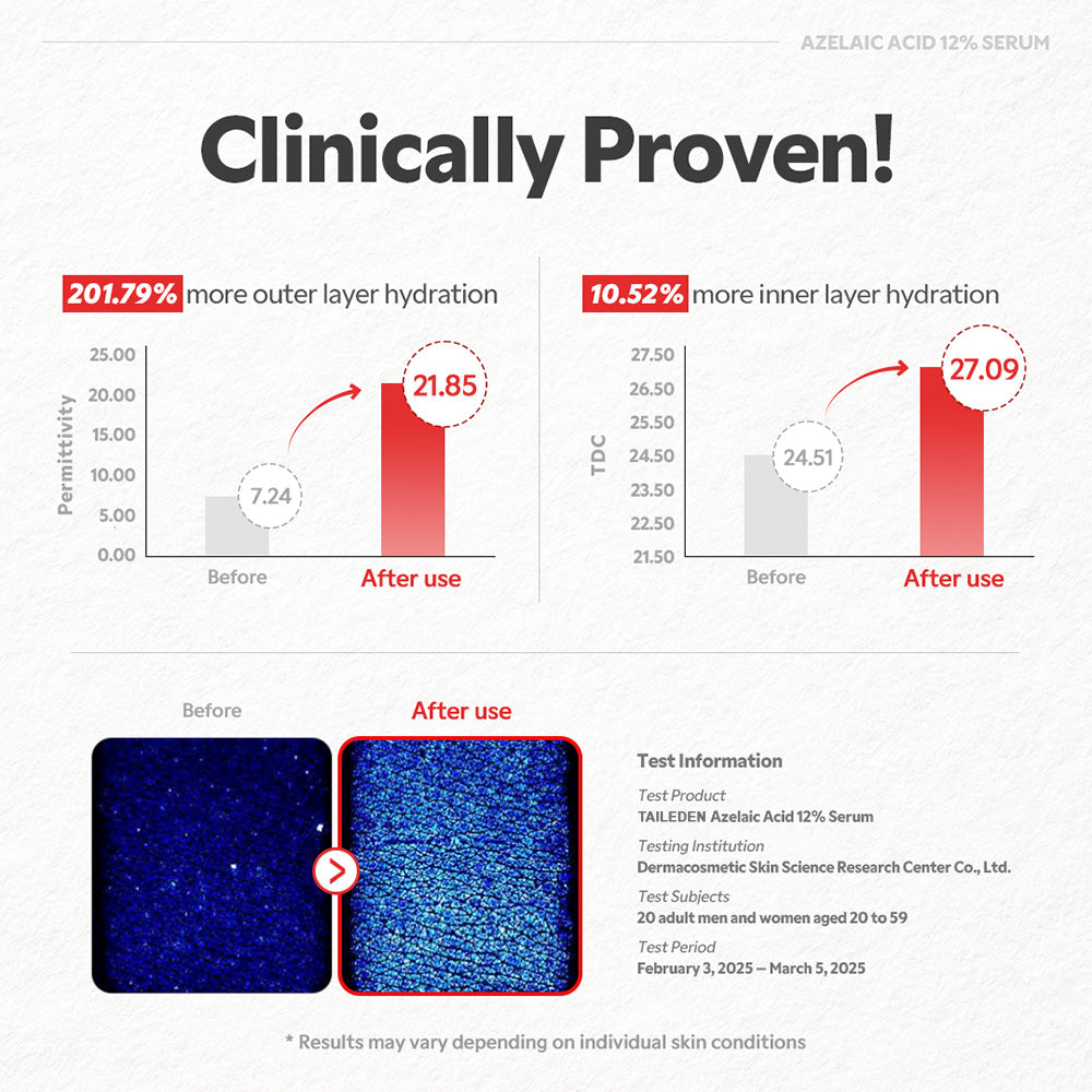 Azelaic Acid 12% Serum - Lightweight Dark Spot Reducer, Gentle Breakout care, For Uneven skin tone, Redness, Red Marks and Acne