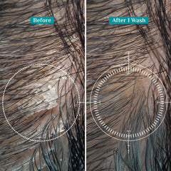 Smooth & Gentle Deep Cleansing Anti-Dandruff Shampoo